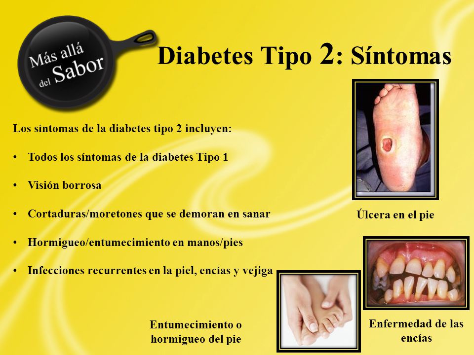entumecimiento de síntomas pre-diabetes entumecimiento de síntomas pre-diabetes